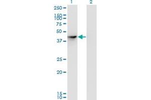 Western Blot analysis of SEPHS1 expression in transfected 293T cell line by SEPHS1 monoclonal antibody (M04), clone 3G3.