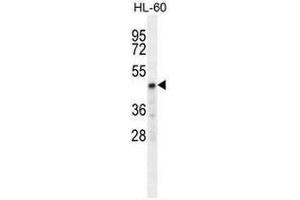 CHST2 Antibody (Center) western blot analysis in HL-60 cell line lysates (35µg/lane). (CHST2 antibody  (Middle Region))