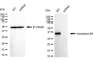 Western blotting analysis using homeobox B4 antibody (ABIN7798992).