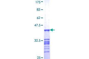 OTUD7B Protein (AA 759-858) (GST tag)