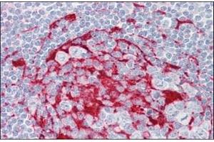 Human Tonsil: Formalin-Fixed, Paraffin-Embedded (FFPE) (LRAT antibody  (Internal Region))