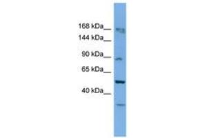 Image no. 1 for anti-TATA Box Binding Protein (TBP)-Associated Factor, RNA Polymerase I, C, 110kDa (TAF1C) (AA 701-750) antibody (ABIN6745644) (TAF1C antibody  (AA 701-750))
