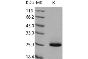 Western Blotting (WB) image for Lipocalin 2 (LCN2) (Active) protein (His tag) (ABIN7320459) (Lipocalin 2 Protein (LCN2) (His tag))