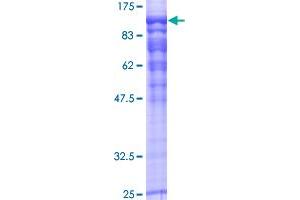 Image no. 1 for RAP1 GTPase Activating Protein (RAP1GAP) protein (GST tag) (ABIN1317397)