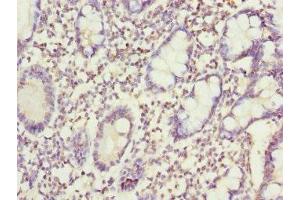 Immunohistochemistry of paraffin-embedded human small intestine tissue using ABIN7170406 at dilution of 1:100 (Sorting Nexin 7 antibody  (AA 85-330))