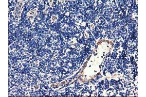 Image no. 4 for anti-Centromere Protein H (CENPH) antibody (ABIN1497471) (CENPH antibody)