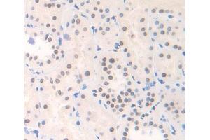 Used in DAB staining on fromalin fixed paraffin- embedded Kidney tissue (YAF2 antibody  (AA 1-177))