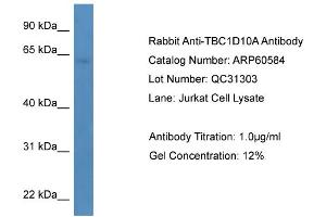 WB Suggested Anti-TBC1D10A  Antibody Titration: 0. (TBC1D10A antibody  (C-Term))