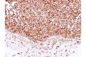 Image no. 1 for anti-2,4-Dienoyl CoA Reductase 1, Mitochondrial (DECR1) (AA 20-276) antibody (ABIN1497807) (DECR1 antibody  (AA 20-276))