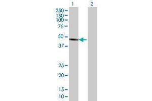 Western Blot analysis of ALLC expression in transfected 293T cell line by ALLC MaxPab polyclonal antibody.