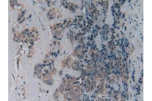 Immunohistochemistry (IHC) image for anti-Lysophosphatidylcholine Acyltransferase 3 (LPCAT3) (AA 122-233) antibody (ABIN7436327)