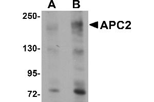Western Blotting (WB) image for anti-APC Regulator of WNT Signaling Pathway 2 (APC2) (Middle Region) antibody (ABIN1030861) (APC2 antibody  (Middle Region))