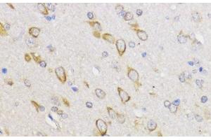 Immunohistochemistry of paraffin-embedded Rat brain using Bcl-2 Polyclonal Antibody at dilution of 1:100 (40x lens). (Bcl-2 antibody)