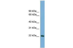 WB Suggested Anti-Rgs1 Antibody Titration:  0. (RGS1 antibody  (N-Term))