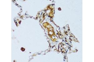 Immunohistochemistry of paraffin-embedded Human lung using C1QC Polyclonal Antibody at dilution of 1:100 (40x lens). (C1QC antibody)