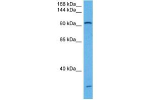 Host:  Rabbit  Target Name:  UBE3A  Sample Tissue:  Mouse Kidney  Antibody Dilution:  1ug/ml (ube3a antibody  (Middle Region))