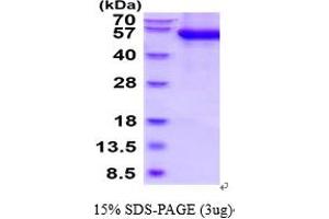 SDS-PAGE (SDS) image for Lymphocyte Antigen 9 (CD229) (AA 48-454) protein (His tag) (ABIN6387850) (LY9 Protein (AA 48-454) (His tag))