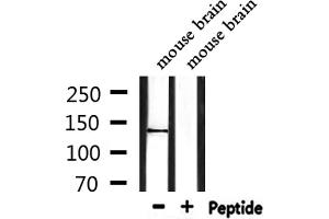 Western blot analysis of extracts from mouse brain, using TRPS1 Antibody. (TRPS1 antibody  (N-Term))