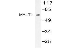 Western blot (WB) analysis of MALT1 antibody in extracts from HUVEC cells. (MALT1 antibody)