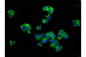 Immunofluorescence staining of MCF-7 cells with ABIN7175101 at 1:66, counter-stained with DAPI. (SLC14A1 antibody  (AA 1-51))