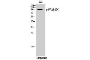 Western Blotting (WB) image for anti-PR (pSer294) antibody (ABIN3173167) (PR (pSer294) antibody)