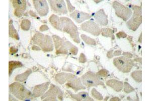 Immunohistochemical analysis of paraffin-embedded human heart tissue using COL5A1 polyclonal antibody .