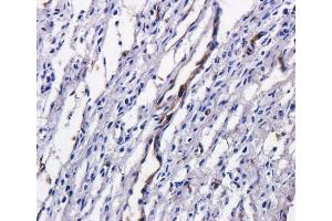 Immunohistochemistry (IHC) image for anti-TAG-72 (Satumomab Biosimilar) antibody (ABIN5668023)