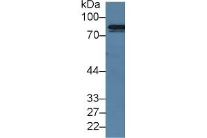 Western Blotting (WB) image for anti-Coagulation Factor XIII, A1 Polypeptide (F13A1) (AA 372-616) antibody (ABIN7442897)