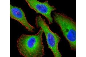 Fluorescent confocal image of HeLa cells stained with Tuberin antibody. (Tuberin antibody  (AA 1776-1805))