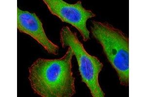 Fluorescent confocal image of HeLa cells stained with Tuberin antibody.