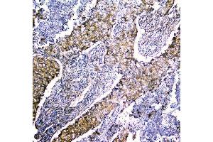 IHC analysis of LRTOMT using anti-LRTOMT antibody (ABIN7602986). (Leucine Rich Transmembrane and 0-Methyltransferase Domain Containing (LRTOMT) (Middle Region) antibody)