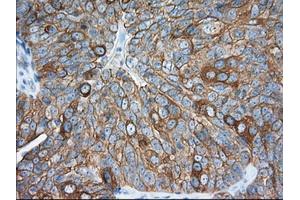 Immunohistochemistry (IHC) image for anti-Transforming, Acidic Coiled-Coil Containing Protein 3 (TACC3) antibody (ABIN1498098) (TACC3 antibody)