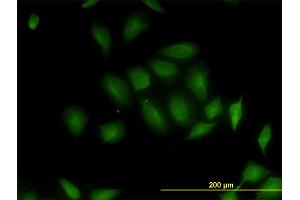 Immunofluorescence of monoclonal antibody to RP6-213H19. (STK26/MST4 antibody  (AA 1-137))