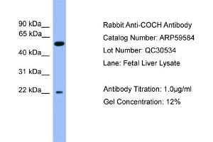 WB Suggested Anti-COCH  Antibody Titration: 0. (COCH antibody  (C-Term))