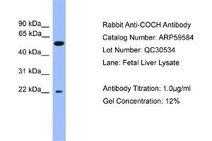 WB Suggested Anti-COCH  Antibody Titration: 0.