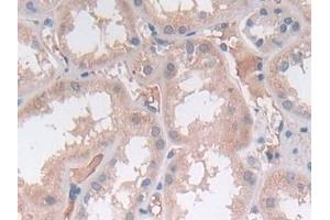 Immunohistochemistry (IHC) image for anti-Sex Determining Region Y (SRY) (AA 1-204) antibody (ABIN7441337)