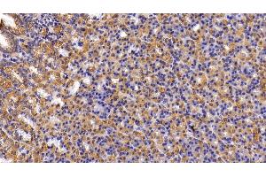 Immunohistochemistry (IHC) image for anti-Keratin 6A (KRT6A) (AA 163-468) antibody (ABIN7435445)