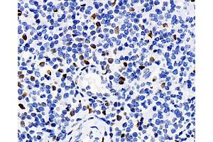 Immunohistochemistry analysis of paraffin-embedded human tonsil using ERK 2 Polyclonal Antibody at dilution of 1:100. (ERK2 antibody)