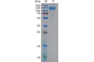 Human ANPEP Protein, His Tag on SDS-PAGE under reducing condition. (CD13 Protein (His tag))