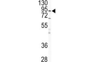 Western Blotting (WB) image for anti-Inhibitor of kappa Light Polypeptide Gene Enhancer in B-Cells, Kinase beta (IKBKB) antibody (ABIN3031320)