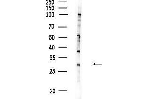 anti-Mannose-6-Phosphate Receptor (Cation Dependent) (M6PR) (Internal Region) antibody