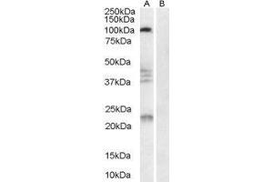 Western Blotting (WB) image for Reticulon 4 Receptor (RTN4R) peptide (ABIN369422) (Reticulon 4 Receptor (RTN4R) Peptide)