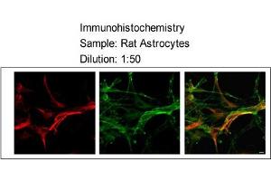 Sample type:    Rat Astrocytes  Dilution:    1:50 (MLC1 antibody  (Middle Region))