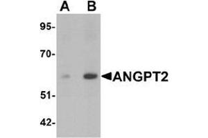 Western blot analysis of ANGPT2 in human liver tissue lysate with ANGPT2 antibody at (A) 1 and (B) 2 ug/mL.