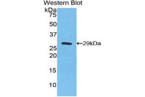 Western Blotting (WB) image for anti-Inhibitory Subunit of NF-KappaB zeta (AA 422-651) antibody (ABIN1859325) (Inhibitory Subunit of NF-KappaB zeta (AA 422-651) antibody)