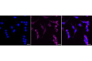 anti-Ras Homolog Gene Family, Member Q (RHOQ) antibody