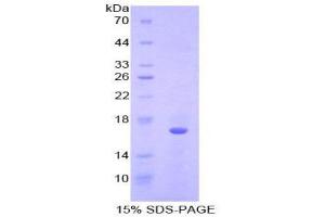 SDS-PAGE (SDS) image for Fibroblast Growth Factor 23 (FGF23) (AA 157-238) protein (His tag) (ABIN1170427)
