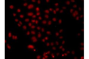 Immunofluorescence analysis of A549 cell using HNRNPA1 antibody. (HNRNPA1 antibody)