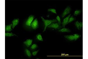 Immunofluorescence of monoclonal antibody to ADRM1 on HeLa cell. (ADRM1 antibody  (AA 18-407))