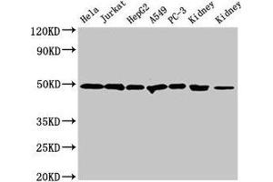 Western Blot Positive WB detected in: Hela whole cell lysate, Jurkat whole cell lysate, HepG2 whole cell lysate, A549 whole cell lysate, PC-3 whole cell lysate, Rat kidney tissue, Mouse kidney tissue All lanes: CALR antibody at 2 μg/mL Secondary Goat polyclonal to rabbit IgG at 1/50000 dilution Predicted band size: 49 kDa Observed band size: 49 kDa (Calreticulin antibody  (AA 18-415))